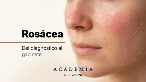 🪭 Masterclass: Rosácea, del diagnóstico al abordaje en gabinete